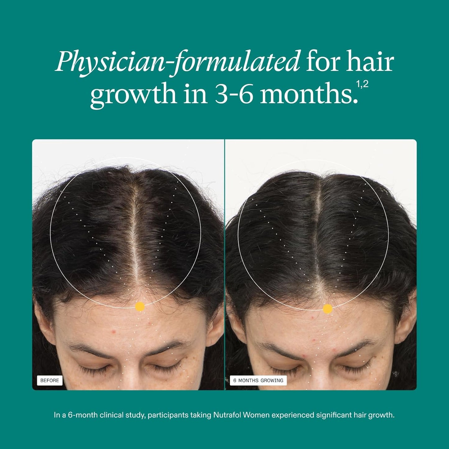 Nutrafol Women’s Hair Growth Supplement 18–44, Thicker, Stronger Hair