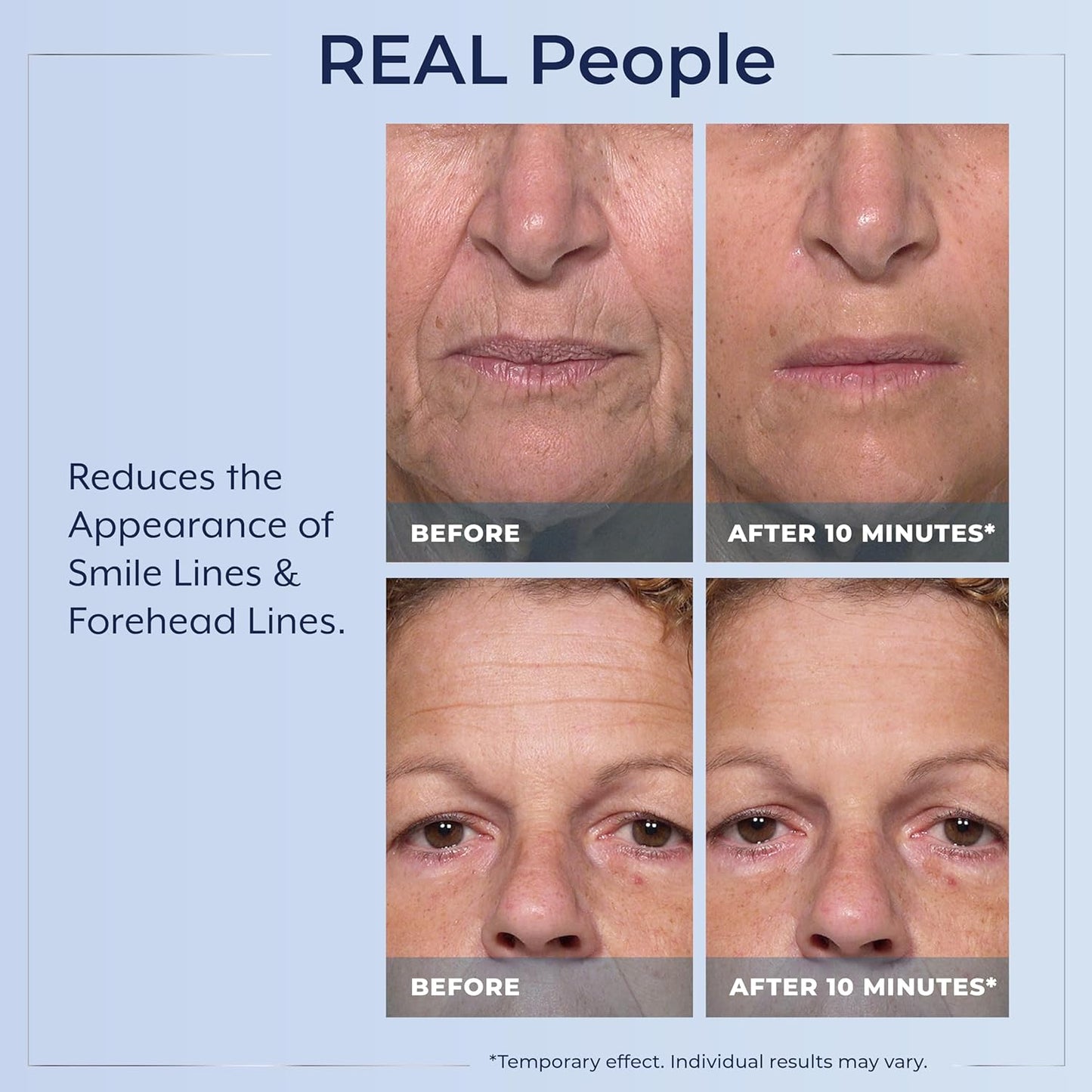 Plexaderm Rapid Reduction Eye Serum - Instant Wrinkle Remover