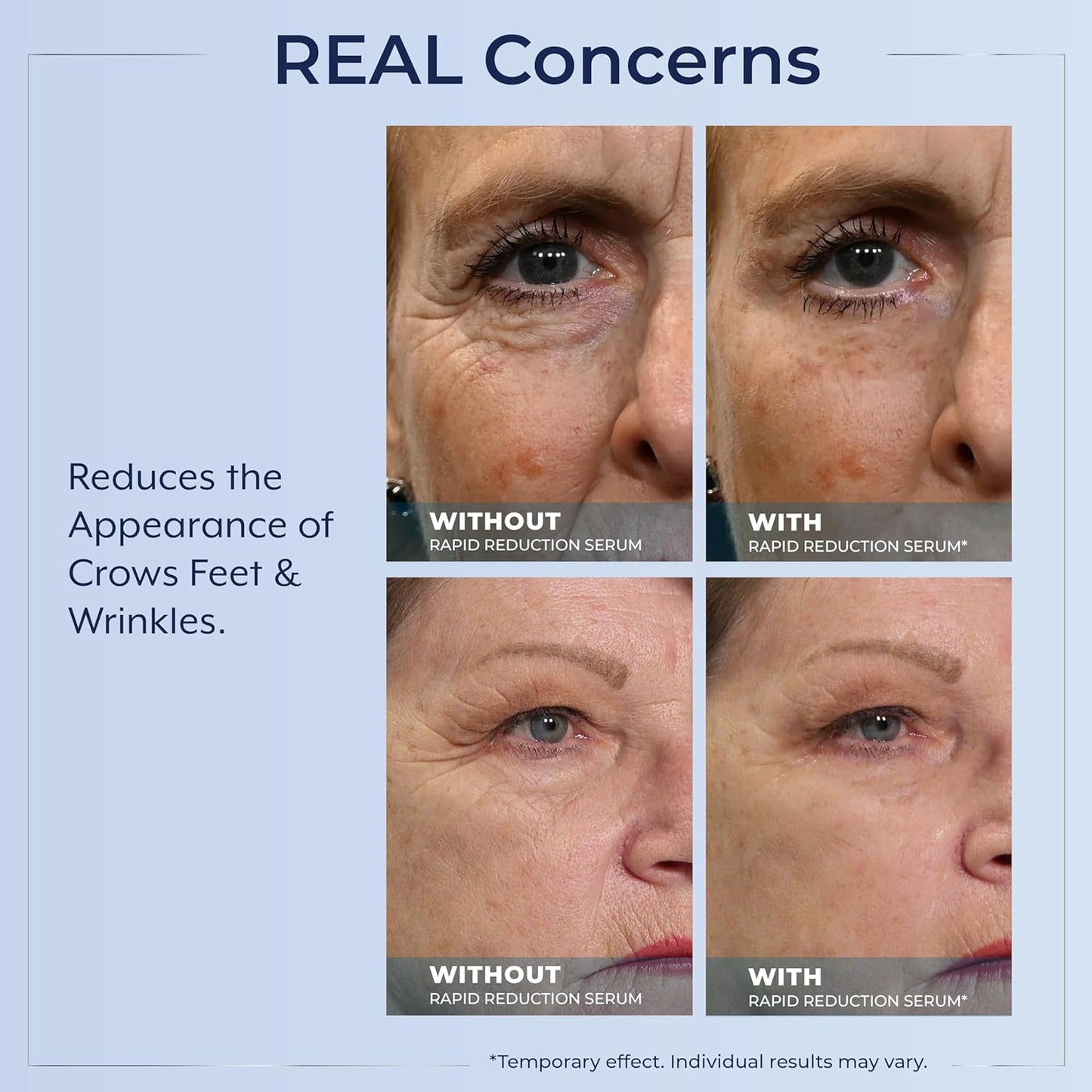 Plexaderm Rapid Reduction Eye Serum - Instant Wrinkle Remover
