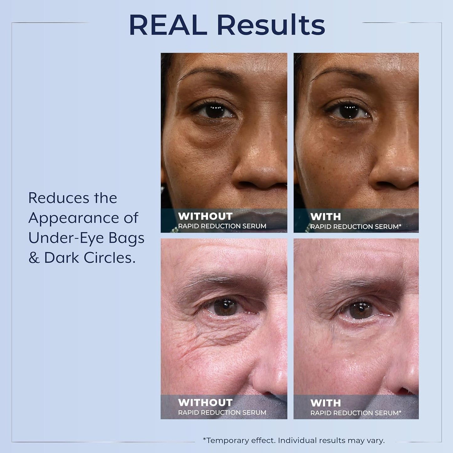 Plexaderm Rapid Reduction Eye Serum - Instant Wrinkle Remover