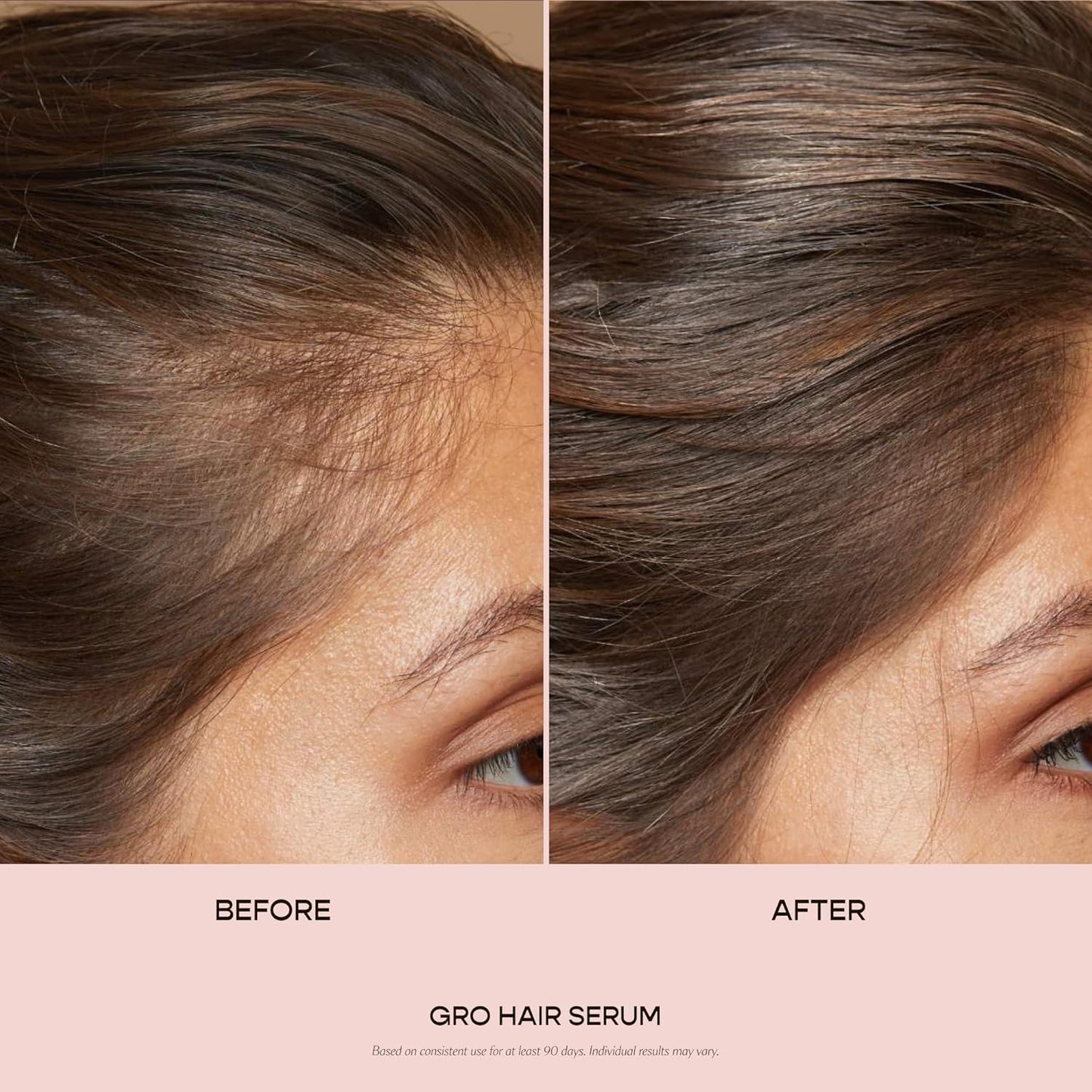 VEGAMOUR GRO Hair Serum 30ml – Thicker, Fuller Hair in 90 Days, Vegan