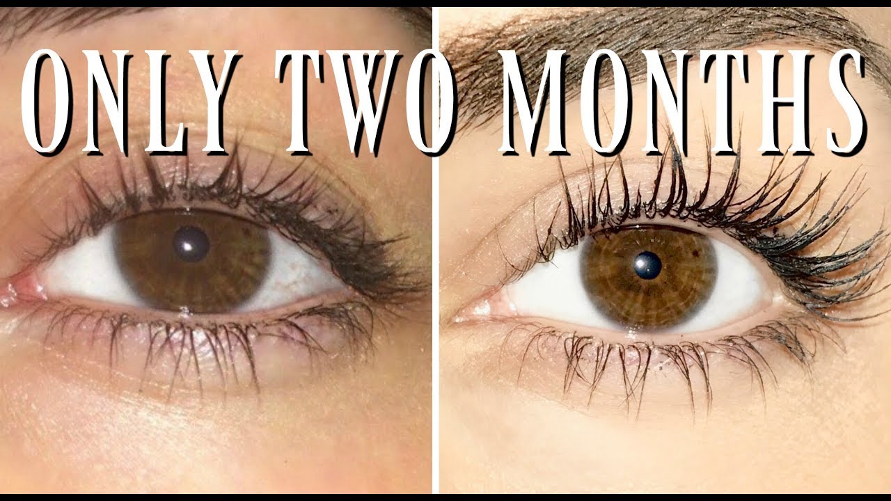 Load video: How I Got Longer, Fuller Lashes Using LiLash Beauty Purified Eyelash Serum