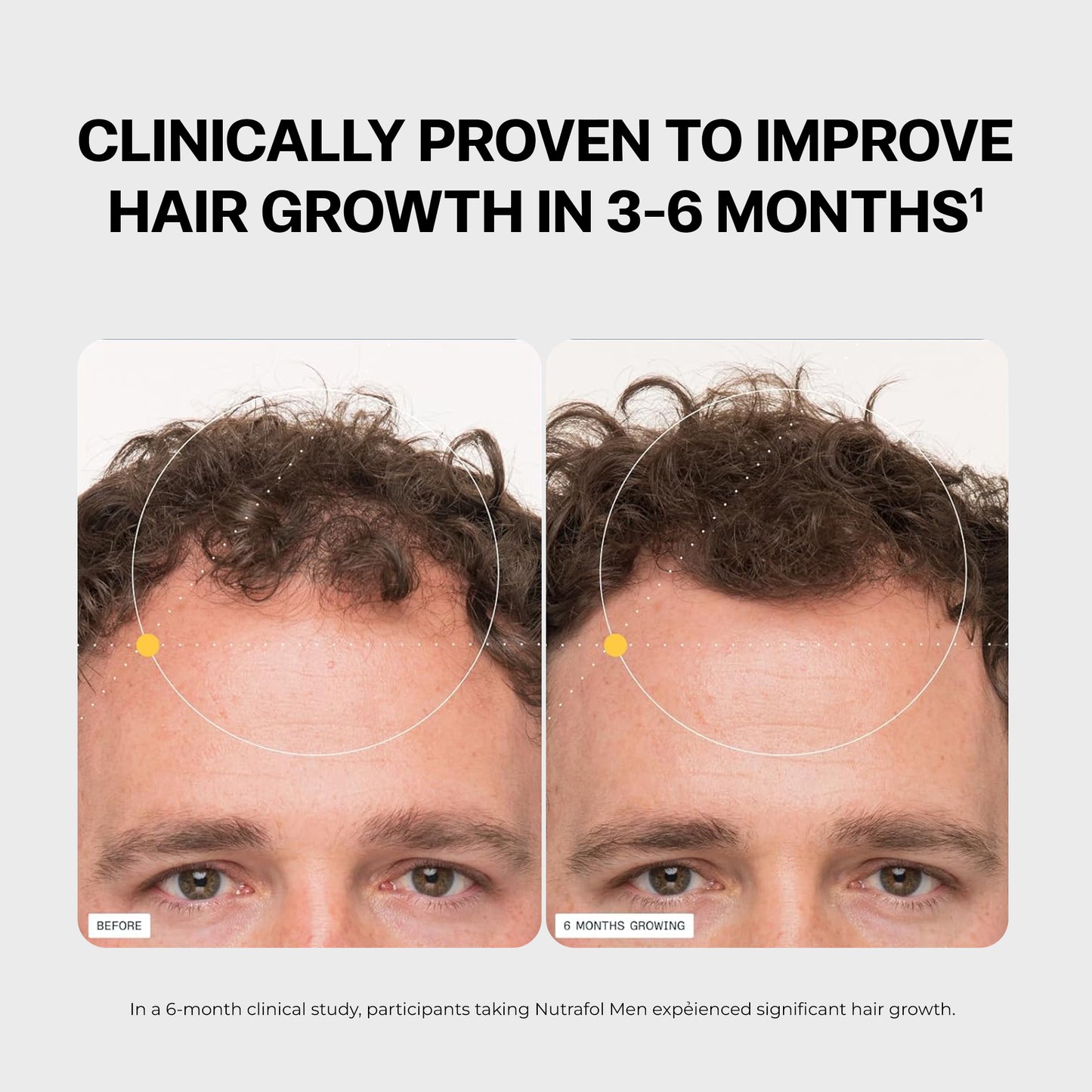 Nutrafol Men’s Hair Growth Supplement, Thicker Fuller Hair, 1 Month Supply