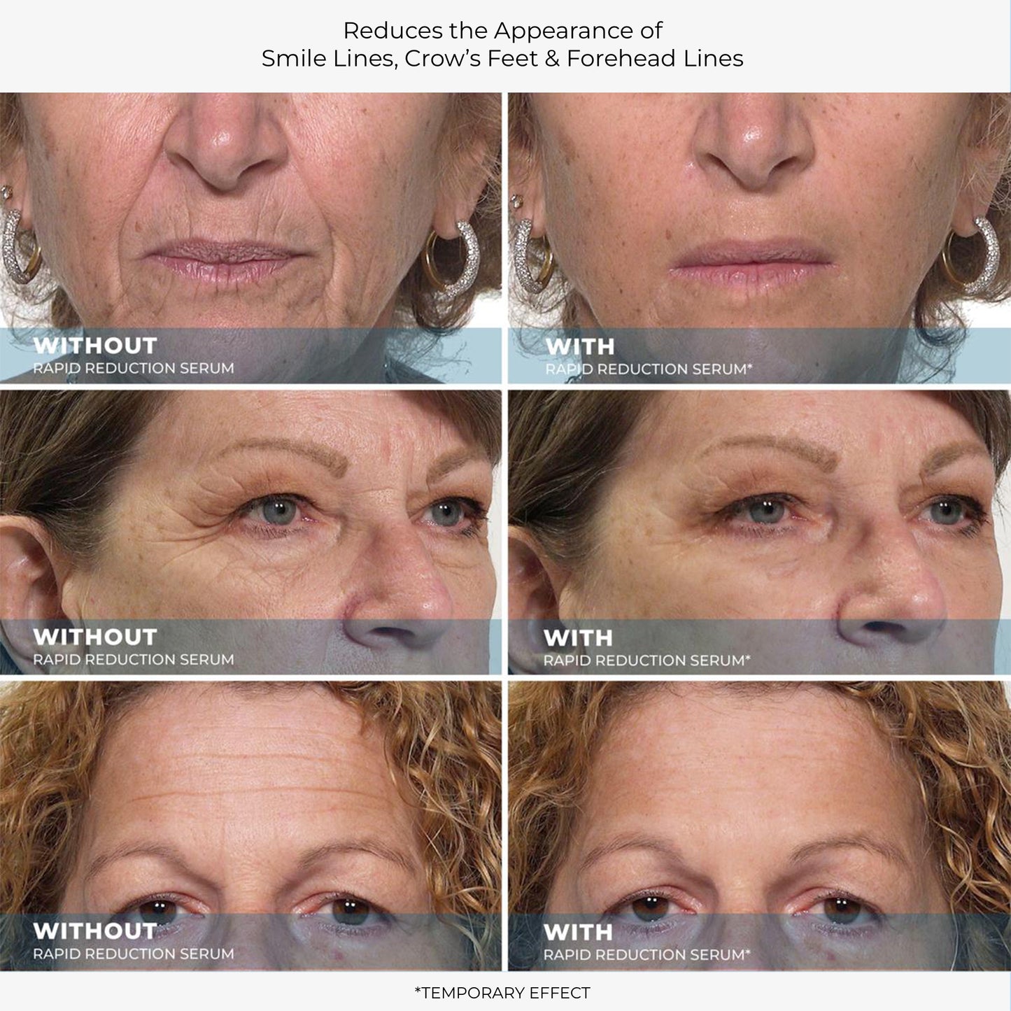 Plexaderm Eye Serum – Instant Wrinkle, Dark Circle & Under-Eye Bag Reducer